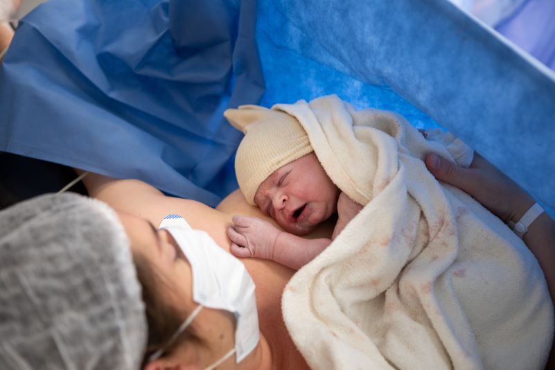 Projet de naissance césarienne : nouveau-né placé contre sa maman juste après la naissance en salle d'opération, favorisant le premier contact et le lien d'attachement.Cette photo montre les premiers instants de vie d'un bébé après une césarienne. Installé contre sa maman dès la naissance, le nouveau-né bénéficie d'un contact précoce favorisant l'attachement et la transition vers la vie extra-utérine. Cette image illustre un aspect souvent intégré dans un projet de naissance césarienne : encourager le peau à peau précoce, le respect du lien mère-enfant et une prise en charge plus douce et personnalisée en salle de naissance.